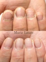 マリーロール 天王寺店(Marie Laure)/深爪改善/自爪育成/ネイルケア