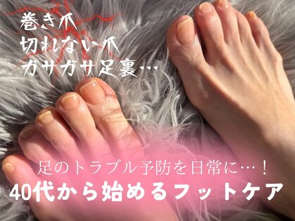 爪のいろはの写真