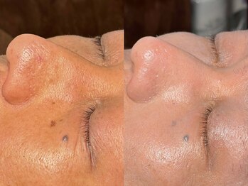 ルーナジェーナ(Luna llena)/