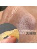 毛穴悩み【フェイシャルWAX】天然100％マツヤニを使用した全顔毛穴の大掃除☆