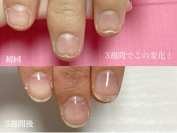 ウィッチ(witch)/たった3週間で激的な変化!!