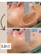 リーシャ(Reesha)/Litの効果☆