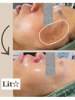 リーシャ(Reesha)/Litの効果☆