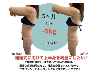 ベル(BeL)/筋膜リリース×痩身【5ヶ月】