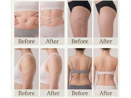 エヴァーグレース プレミシャス 心斎橋店(EVER GARACE Premycious)の写真