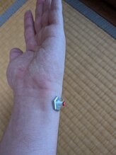 つむぎ養生堂マッサージ処/お灸でセルフケア