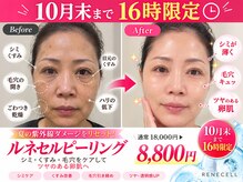 上野エステサロン レア(Lea)