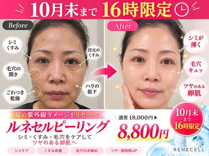 上野エステサロン レア(Lea)の写真