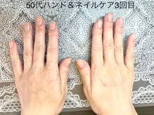 桃の木 吉祥寺店/５０代お薦め　ハリ弾力アップ