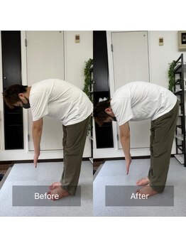 ナオル整体 池袋院(NAORU整体)/骨盤矯正の施術前後【池袋整体】