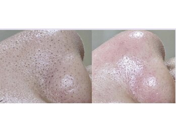 ジェリー(JERRY)/艶々