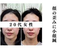 ボディーリメイカー 浅草橋(BODY REMAKER)/持続性の長い美容鍼