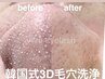 【VIP様女性専用】韓国式3D毛穴洗浄◆¥17900→¥8900