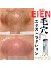 【毛穴超音波洗浄全顔】イオン導入毛穴エクストラクション16,500円