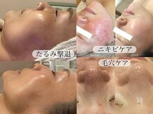 グランヴェルジェ(Granverger)