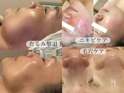グランヴェルジェ(Granverger)の写真