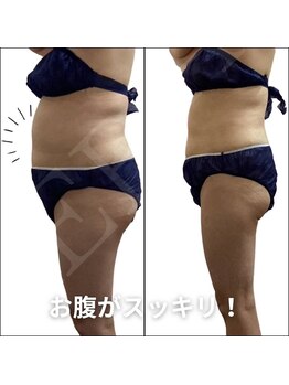 エアリアル 八女店/50代以降の方も成功者続出！！