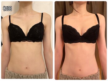 美人バスト 小倉店/バストアップ◇症例◇体型の変化
