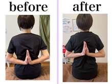 トップフィット(Top Fit)の雰囲気（◇肩甲骨剥がし◇大人気メニュー！肩こり解消・姿勢改善）