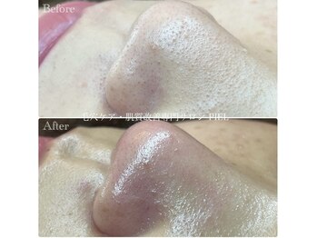 ピエル 北千住店(PIEL)/新年度