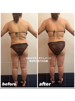 ソリデンテ 心斎橋/施術前と後の比較