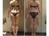 インディバBody【術後ケアも可】60分×3回☆+施術後ホームケア付43,170円