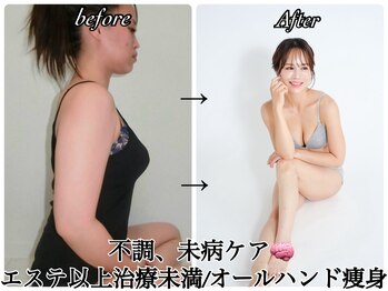 フォルスボーテ(Force Beaute)