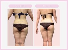 スリムライン 山形店(The Slim Line)/before→after