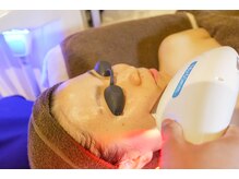 アンジェロ/【脱毛】顔脱毛