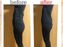 ヨサパーク リリー(YOSA PARK Lily)/