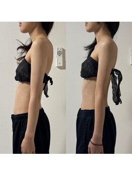 サンク(Cinq)/【整体+猫背矯正】巻き肩改善