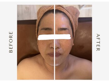 マオ(mao)/☆2回Before→after☆