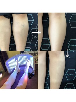 トータルヘルスビューティーカズ(TotalHealthBeauty KAZU)/【血行促進・冷えむくみ】光の森