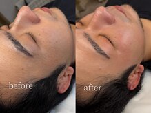 エミュ(e'mu)/男性にも人気のフェイスwax