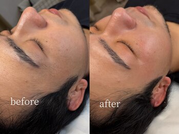 エミュ(e'mu)/男性にも人気のフェイスwax