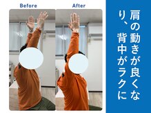 琴似じんぼ整体院/背中の痛み、整体後の変化