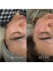 オル(olu)の写真/Face WAXでお顔の産毛と角質を取り除きお顔のトーンUPで艶肌に◎