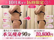 上野エステサロン レア(Lea)