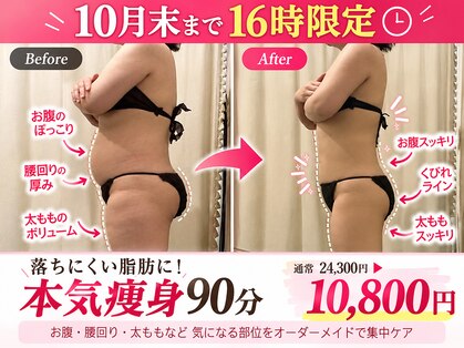 上野エステサロン レア(Lea)の写真