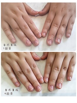ノーブルフルール(Noble fleur)/美爪育成★爪のお悩み改善コース