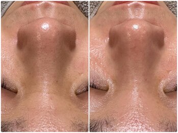 クランシュプール 恵比寿店/【お悩み&予約数No.1】