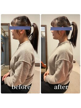 フィジオリハ 久屋大通店/筋膜リリース/ストレートネック