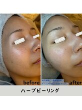 ルアナ 北谷店/ハーブピーリング 《沖縄/北谷》