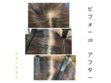 オリエンス(oriens)の雰囲気（純国産、純度100％のヒト幹細胞培養上清液トリプルショット！）
