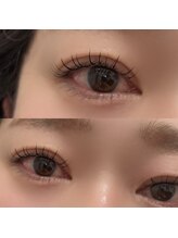 ナル(NALu)/フラットラッシュ