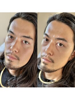 ジュビリー(JuBilee)/眉毛のお悩み是非ご相談ください