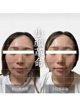 ザ リフト カドモリ 鹿児島 霧島(The Lift KADOMORI)/Before→After