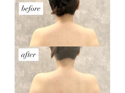 ナヴィグレース(Navi Grace)の写真