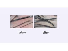 パズ(PAZ)の雰囲気(自分では見えない頭皮のSOS。あなたはいつ気づきますか?)