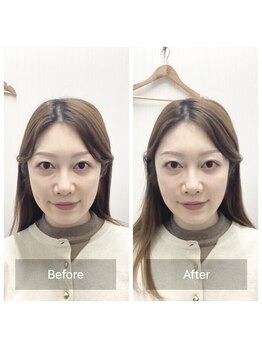 ハリナチュレ 南流山店/お客様のビフォーアフター